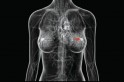 ​Entenda a importância da Mamografia e não deixe para depois